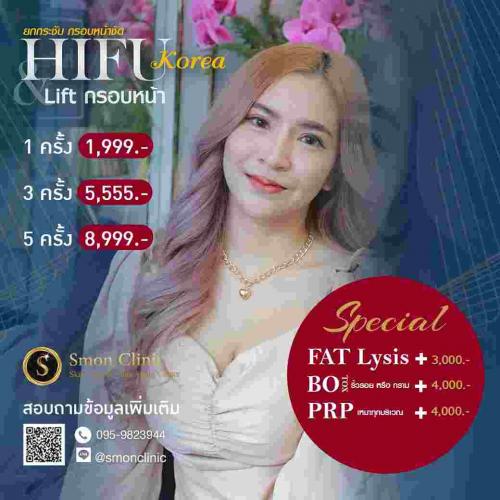 โปรโมชั่น-hifu-korea-1-999-บาท